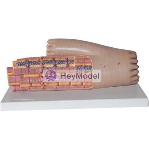 HeyModel Smooth Muscle Dissection Amplification Model