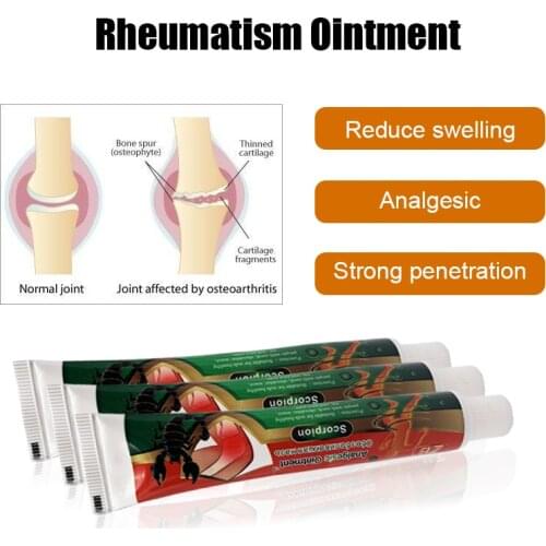 3Tubes ZB Powerful Efficient Analgesic Ointment Scorpion Venom Pain Relief Neuralgia Acid Stasis Rheumatism Arthritis Cream