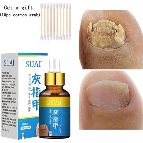 Nail Fungal Treatment Feet Care Essence Nail Foot Whitening Toe Nail Fungus Removal Gel Anti Infection Paronychia Onychomycosis
