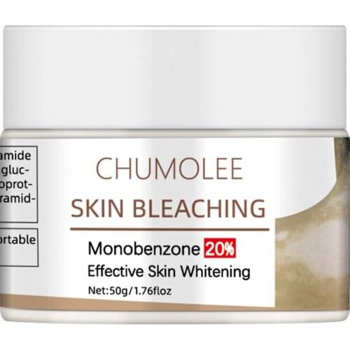 Chumolee Face Whitening Cream Monobenzone Skin Bleaching White Spot Vitiligo Treament Fade Dark Spots Age Spot Bright Skin Face