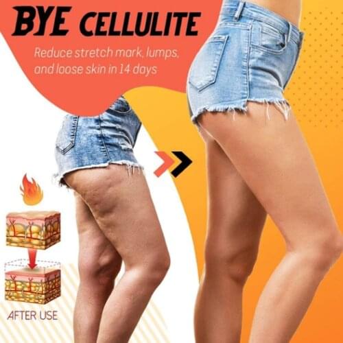 20ml Fast Fat Burning Slimming Spray Weight Loss Essential oil Spray Ultra Absorption Cellulite Removal for Arm Buttocks Abdomen