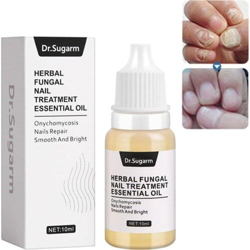 10ml Effective Nail Cream Fungus Removal Nail Treatment Repai Protector Herb Fungus Nail Psoriasis Care Foot Nail Fungus Ag U7A7