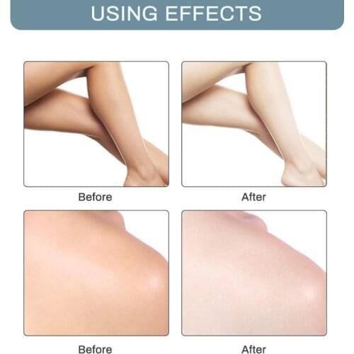 Y1UF 60ml Women Underarm Instant Whitening Cream Armpit Leg Knee Lips Private Part Body Bleach Brighten Lotion