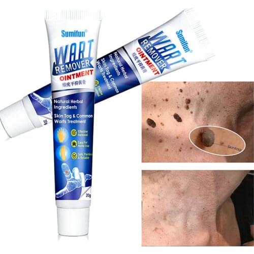 Wart Removal Body Warts Treatment Antibacterial Cream Foot Meat Corn Skin Tag Remover Foot Corn Removal Plantar Warts Ointment