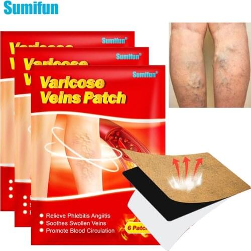 Sumifun 6/12/24Pcs Varicose Veins Treatment Blood Vessel Swelling Spider Leg Vasculitis Phlebitis Care Angiitis Plaster Patch