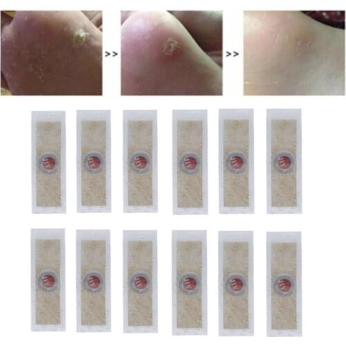 12pcs Medical plaster Foot Corn Removal Remover Warts Thorn Plaster Of Calluses Patch Callosity Detox Foot Pad Foot Care Tools