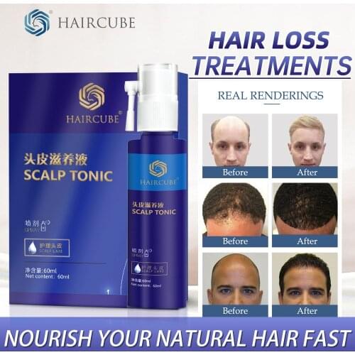 Hair Growth Essence Control Oil Nourishing Hair Help Growth Hair Treatment for Anti hair Loss Sets Natural Herbal Oil Hair Care