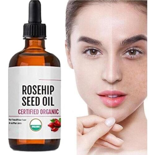 New Plant Rosehip Essential Oil Moisturizing Brighten Body Skin Essential Anti-Aging Anti-Dry Color Oils Care Face Massage F2C6