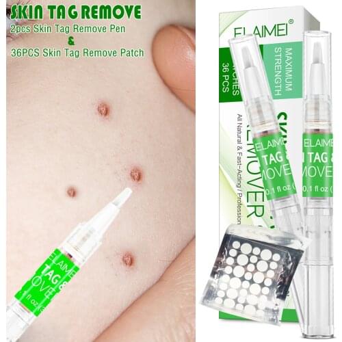 1 Set Skin Tag Remover Kit Patch Ance Pimple Patch Plaster Acne Cream Hydrocolloid Master Anti-infection Wart Removal Liquid