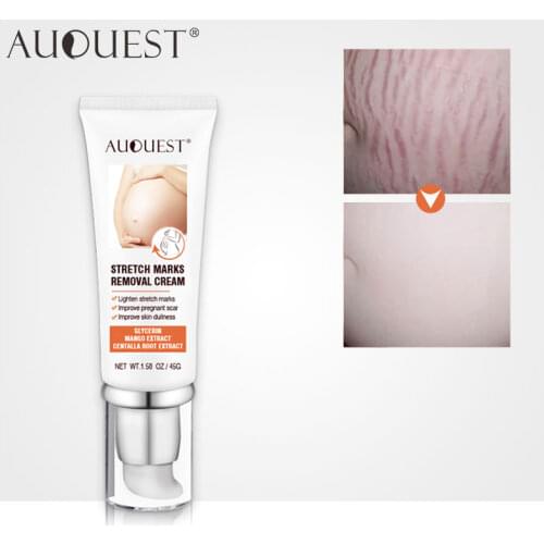 AUQUEST Stretch Marks Removal Maternity Scar Acne Remover for Pregnant Women Anti-Aging Skin Firming Cream Body Care 45g