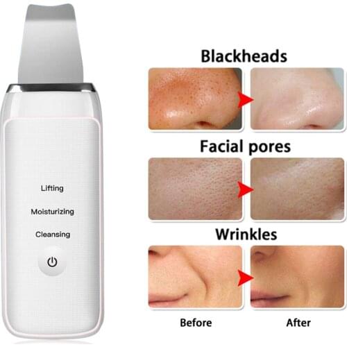 Beurha Facial Cleansing Tools