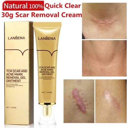 Acne Scar Removal Cream Acne Stretch Marks Facial Gel Repair Smooth Whitening Moisturizing Body Skin Care Spot Treatment LANBENA