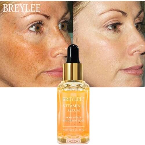 BREYLEE Vitamin C Face Serum Whitening Brighten Fade Dark Spots Remove Freckle Dark Circle Remover Facial Essence Skin Care