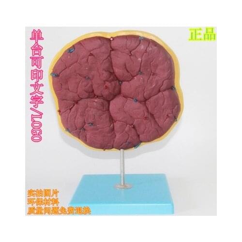 Human placenta Umbilical artery Maternity modelembryo model 22*23*4cm