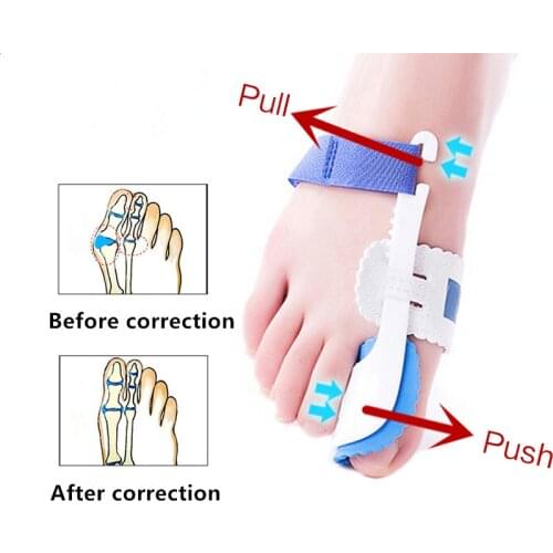 2Pcs Toe Separator Hallux Valgus Corrector Toe Corrector Bunions Finger Separator Haluksy Separator For Toes Bunion Corrector