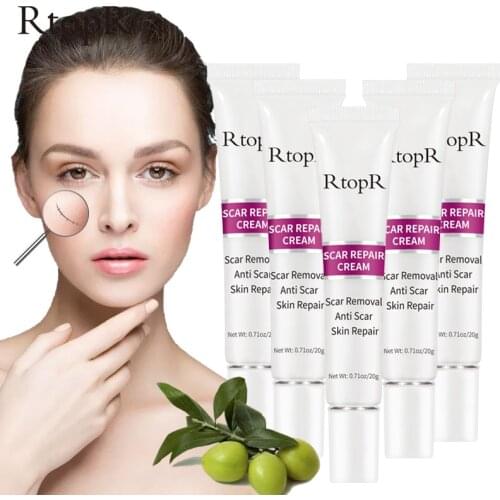5pcs RtopR Repair Removes Scar Cream Care Improves Skin Deep Repair Skin Removes Scars Whitening Skin Firming Skin Lifting Gloss