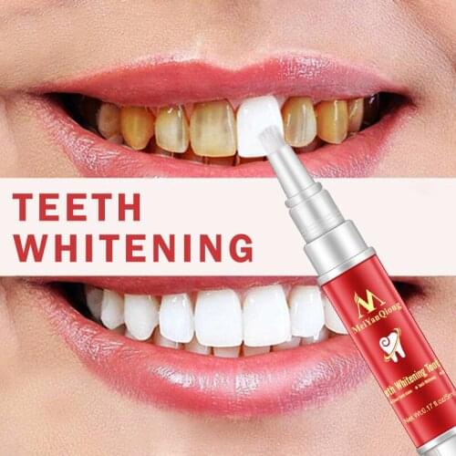 1pc 5ml Teeth Whitening Pen Regain Sexy Smlie Stain Remover Brighten Teeth Blanqueador Dropship Tooth Whitening Products TSLM1