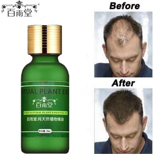 Hair Care Growth Essential Oils Essence Original Authentic 100% Hair Loss Liquid Health Care Beauty Dense Growth Serum