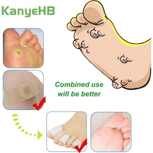 4pcs Toe Separator + 12pcs Foot Corn Removal Plaster Foot Care Medical Plaster Calluses Plantar Warts Thorn Pain Relief Plaster