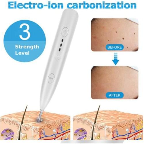 Electric Portable Mini Skin Tag Removal Spot Removal Pen Mole Removal Wart Remover Machine Easy Use Effective