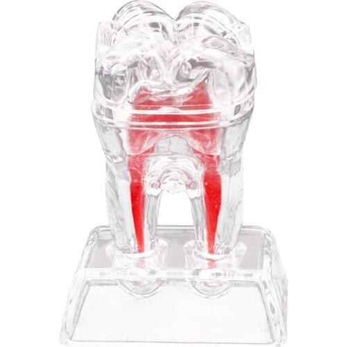 1pc Large Tooth Molar Model Separable Dental Crystal Base Hard Plastic Teeth Teaching Demonstration Model Dental Lab Material