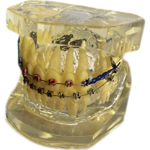 1 pcs Dental Standard Teeth Transparent Model Teach Study Dentistry Material Dentist Tools Dental Lab Material