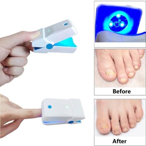 Lastek Anti Fungal Toe Nail Fungus Laser Treatment Device for Paronychia Onychomycosis Physiotherapy GD-N