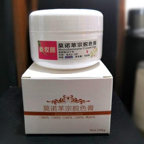 MONOBENZONE 20% White face whitening cream fades skin tone clears blemishes age spots Decolorizing cream 30g/50g/100g
