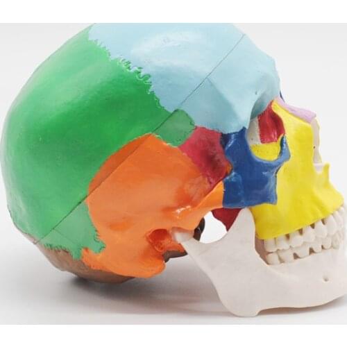 Anatomy Medical Instruments Life Size Painted Didactic Human Anatomical Skull Traumatic Medical Skeleton Trauma