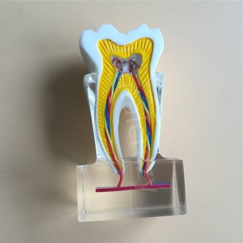 Dental Anatomical Molar Model molar inner structure with nerves and vessels Teeth Model 2018