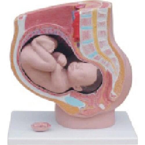 Chinon Pregnancy Model (Sagittal Anatomy) Medicine Student Medical Science Education Teaching Tools Equipment BIX-A1066