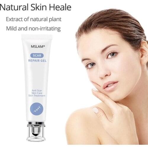 20g Scar Repair Gel Removal Scar Acne Cream Treatment Marks For Face Body Pigmentation Corrector Skin Scar Removal Cream