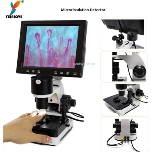 Hot sale 8 Inch Micro-circulation detector examination of human hyperthyroidism microcirculation of Nail Wall Observer
