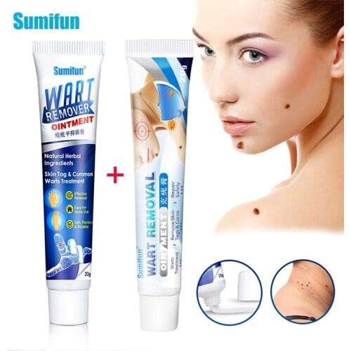 2Types Of Warts Remover Ointment Skin Tag Mole Removal Antibacterial Cream Foot Corn Treatment Herbal Extract Medical Plaster