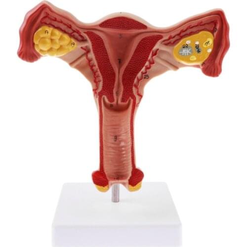Human Pathological Uterus Ovary Model Female Reproductive Organ Model Ovary Vagina Uterus Medical Teaching Anatomy Teaching