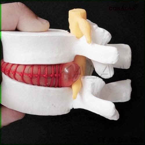 Human anatomy skeleton Spine Lumbar Disc Herniation Teaching Model brain skull traumatic pistol school supplies medical instrume