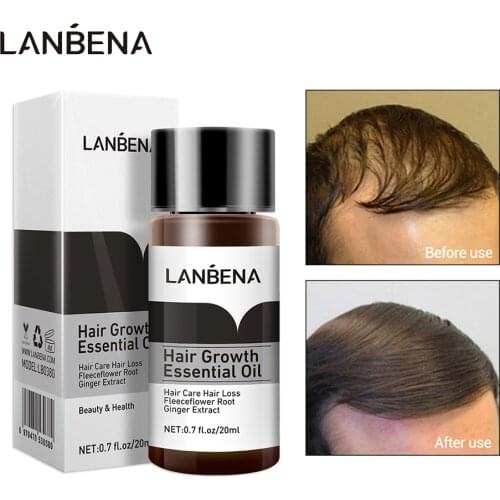 LANBENA Fast Powerful Hair Growth Essence Ginger Ginseng Extract Preventing Hair Loss Cure Scalp Accelerate Hair Growth Care
