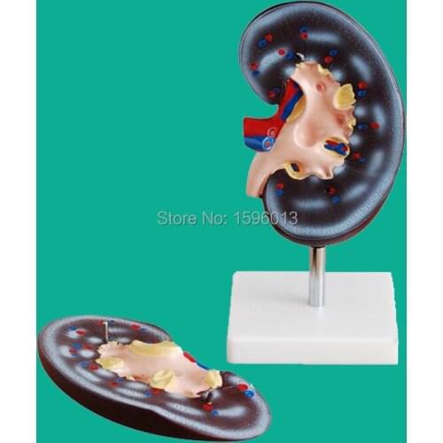 Anatomical Model of Kidney, 2-Part Kidney Model