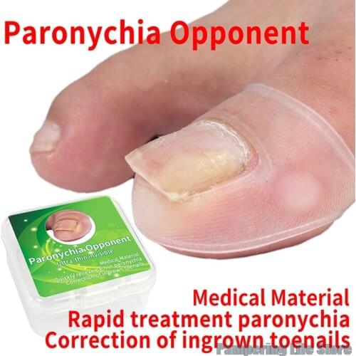 2pc Silicone Ingrown Toenail Correction Tool Invisible Ingrown Toe Nail Treatment Elastic Straightening Clip Brace Pedicure Tool