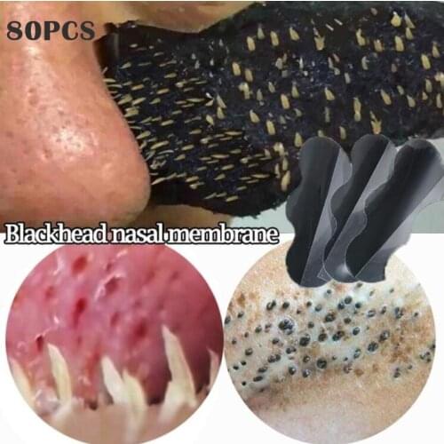 10pcs-80pcs Nose Blackhead Remover Mask Pore Cleaner Acne Treatment Mask Deep Nose Pore Cleasing Strips Black Head Remover Tool