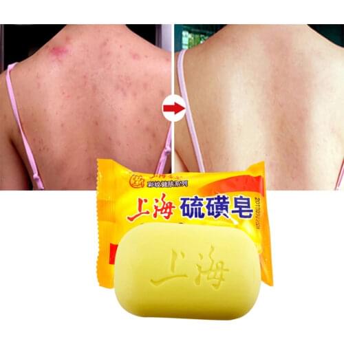 Sulfur Soap Oil-control Acne Treatment Blackhead Remover Soap 85g Whitening Cleanser Skin Care