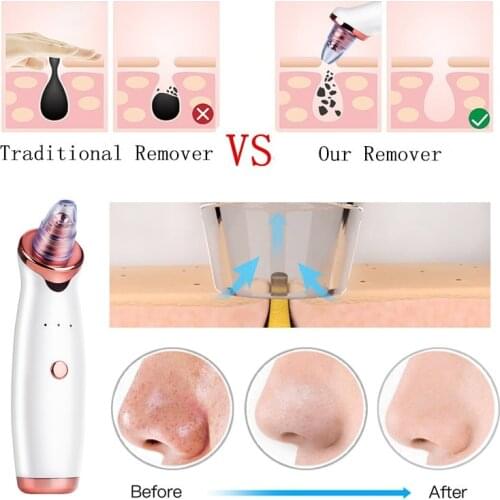 MMA CASTLE Skin Care Devices