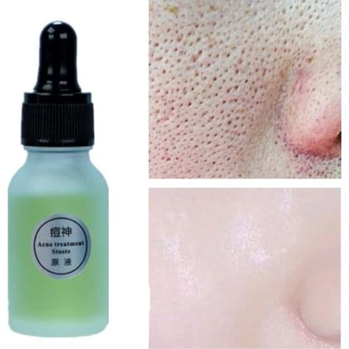 15ML Pore Shrinking Serum Essence Pores Treatment Relieve Dryness Oil-Control Firming Moisturizing Repairing Smooth Acne Removal