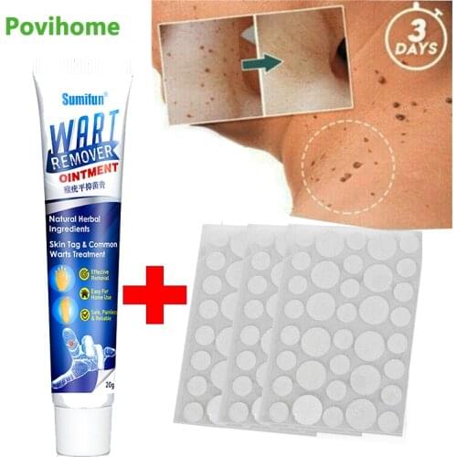 Wart Removal Body Warts Treatment Cream Skin Tag Remover Foot Corn Removal Plantar Wart Ointment Skin Tag Remover Acne Stickers