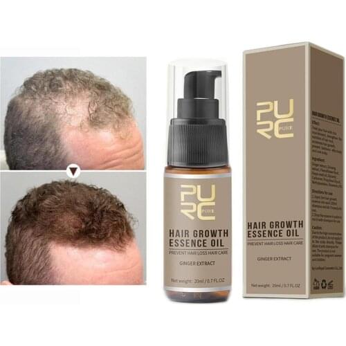 Fast Hair Growth Essence Oil Hair Loss Treatment Help For Hair Care Liquid Nutrition Prevention Hair Removal