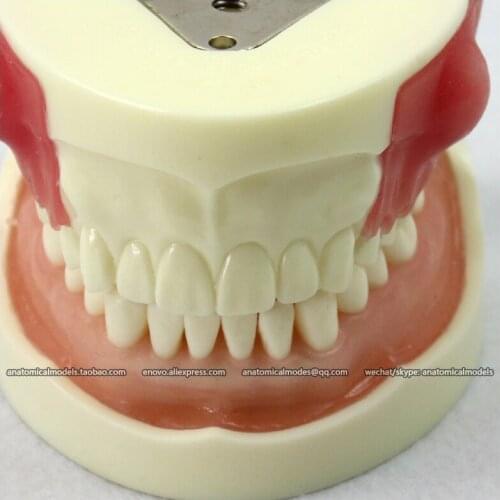 CMAM/12605 Dental- Abscess resection, Human Oral Dental Medical Teaching Anatomical Model
