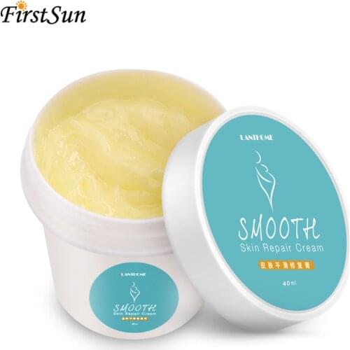 LANTHOME Maternity Smooth Skin Repair Cream for Stretch Marks Remover Acne Scar Removal Body Stretch Mark Cream for Pregnancy