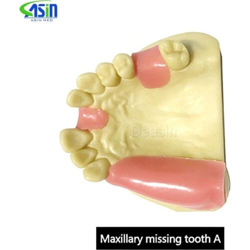 Maxillary Missing Tooth Model Bone Imitating Oral Teaching Aids Dental Implant Placement Exercise Prop Medical Equipment
