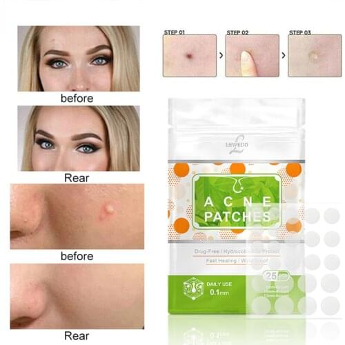 Invisible Acne Removal Pimple Patch Can Absorb Acne Secretions Effectively Invisible Acne Stickers Beauty Skin Care Tool 24PCS