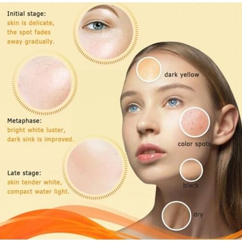 Handmade Papaya Whitening Anti-freckle Soap Face Care Deep Soap Skin Cleaning Wash Brighten Basis Cleansing Face Care Q6W8